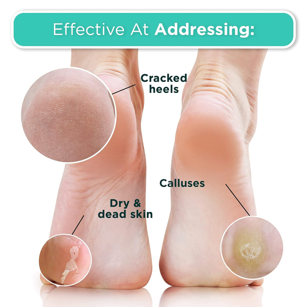 DERMORA Foot Peel Mask 2 Pack for Dry Cracked Feet & Callus
